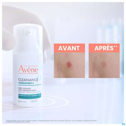 Avene Cleanance Comedomed Gel-cre Konzentrat 30ml, A-Nr.: 5228334 - 12