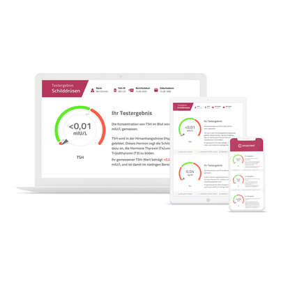 cerascreen Schilddrüsen Test, A-Nr.: 5442889 - 03